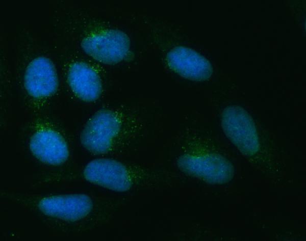  IF analysis of ZNRF3 using anti-ZNRF3 antibody (A02974-1)
