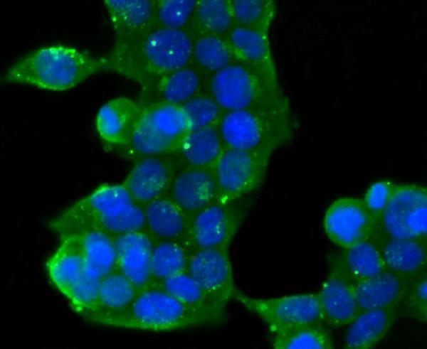 a02975 1 golm1 primary antiboties icc testing 2