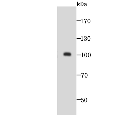 a02975 1 golm1 primary antiboties wb testing 1
