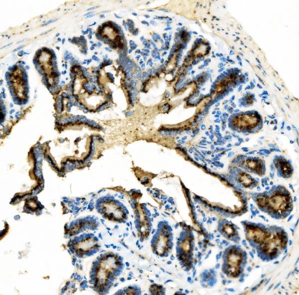 a02975 2 golm1 primary antibodies ihc testing 4