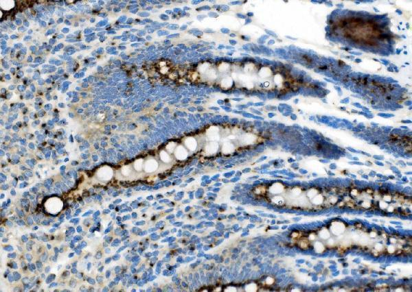 a02975 2 golm1 primary antibodies ihc testing 5