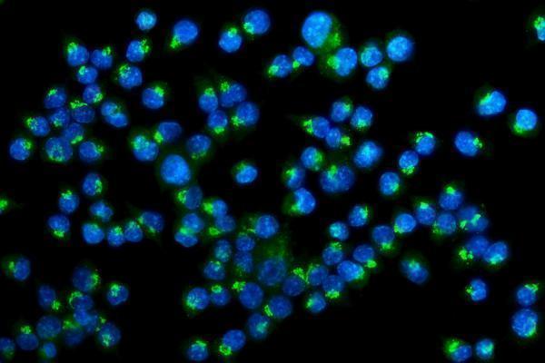 a02975 2 golph2 primary antibodies if testing 1
