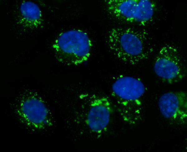 a02975 3 golm1 primary antibodies if testing 2