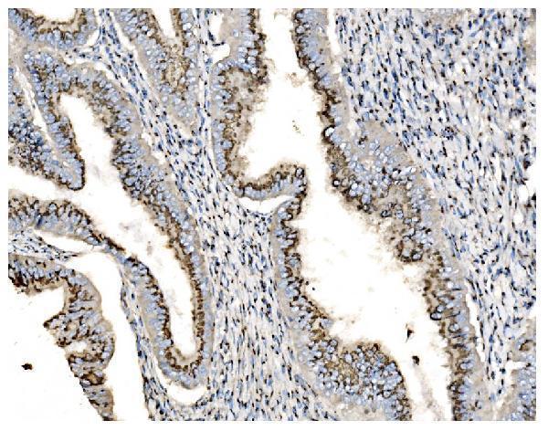 a02975 3 golm1 primary antibodies ihc testing 6