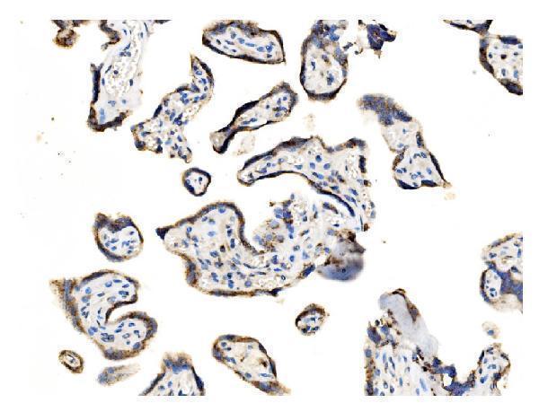 a02975 3 golm1 primary antibodies ihc testing 7