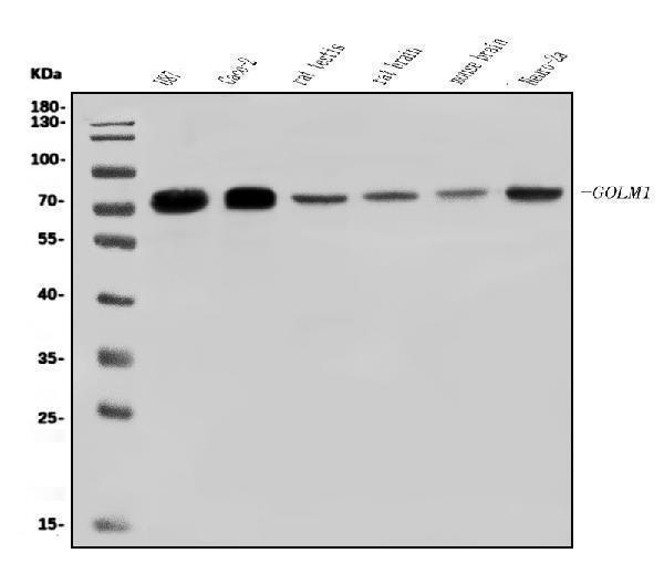 a02975 3 golm1 primary antibodies wb testing 1