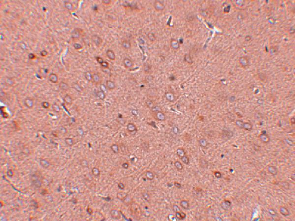 a02975 golm1 primary antibodies ihc testing 2