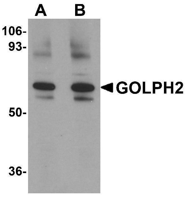 a02975 golm1 primary antibodies wb testing 1
