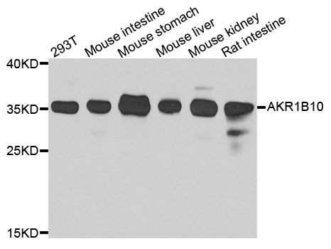 a02976 1 akr1b10 primary antiboties wb testing 1