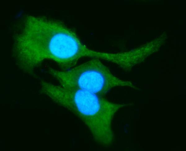 a02976 akr1b10 primary antibodies if testing 4