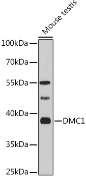 a02978 1 dmc1 primary antiboties wb testing 1