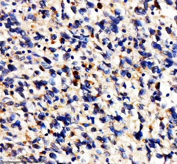 a02979 1 abcb5 primary antibodies ihc testing 4