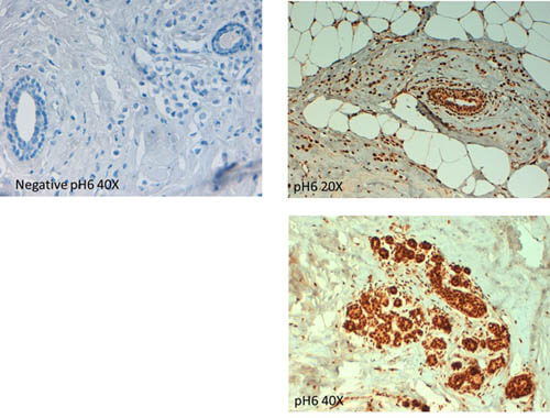 a02979 abcb5 primary antibodies ihc testing 3