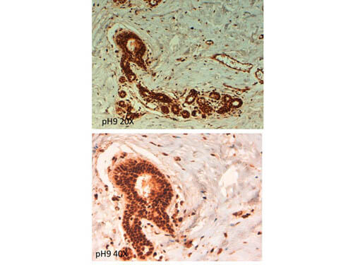 a02979 abcb5 primary antibodies ihc testing 4