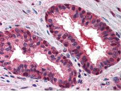 Boster's Anti-CUL2 antibody was diluted 1:500 to detect CUL2 in human prostate tissue