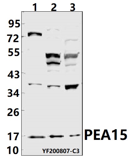 Western blot (WB) analysis of PEA15 pAb at 1:500 dilution
Lane1:The brain tissue lysate of mouse(40ug)
Lane2:C6 whole cell lysate(40ug)
Lane3:HEH293T whole cell lysate(40ug)