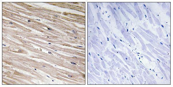 Immunohistochemistry analysis of paraffin-embedded human heart, using PEA-15 (Phospho-Ser104) Antibody
