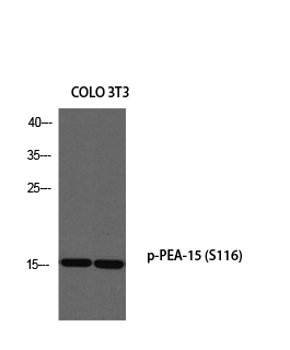 Western blotting validation for Anti-Phospho-PEA-15 (S116) Antibody A02988S116
Western Blot (WB) analysis of COLO205 3T3 using p-PEA-15 (S116) antibody