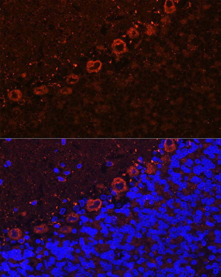 a02991 als2 primary antiboties if testing 3