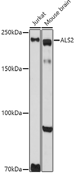 a02991 als2 primary antiboties wb testing 1