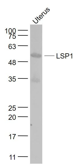 Uterus (Mouse) Lysate at 40 ug
Primary: Anti- LSP1 at 1/1000 dilution
