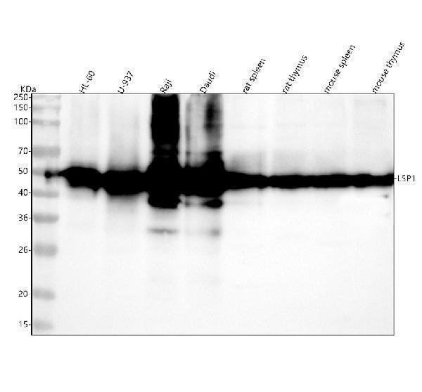  Western blot analysis of LSP1 using anti-LSP1 antibody (A02992-2)