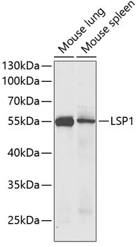 WesternBlot (WB) analysis of LSP1 polyclonal antibody