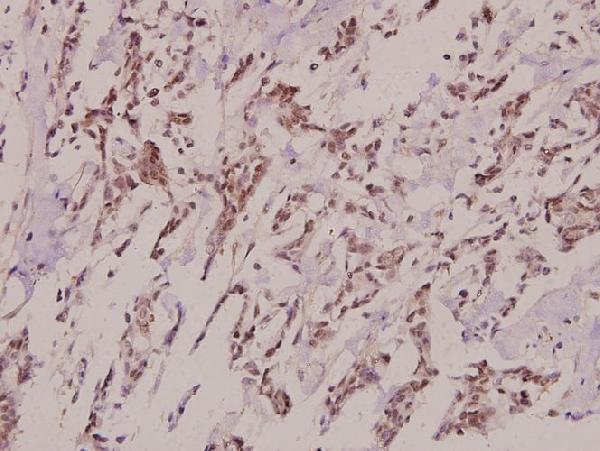 a02993 1 pitx1 primary antiboties ihc testing 2
