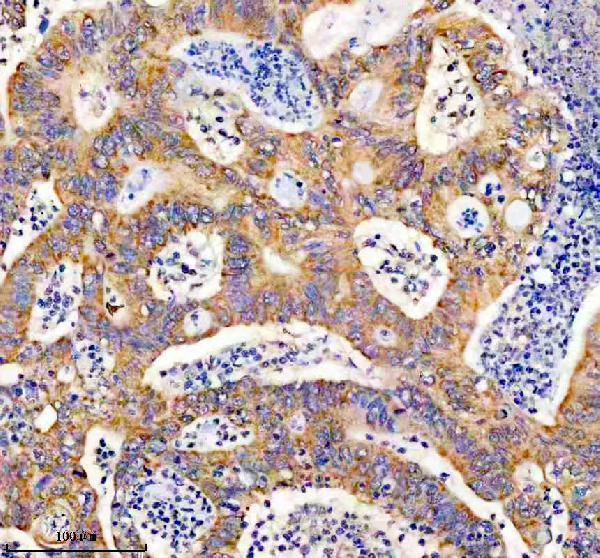IHC analysis of PITX1 using anti-PITX1 antibody (A02993-2)