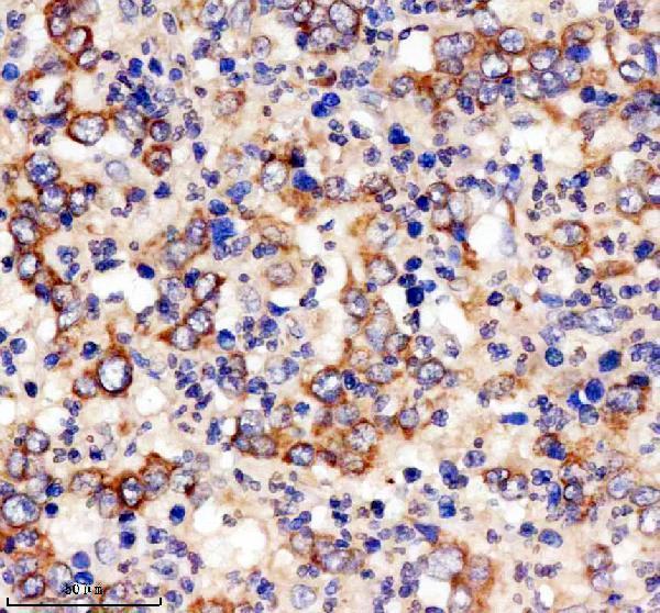 IHC analysis of PITX1 using anti-PITX1 antibody (A02993-2)