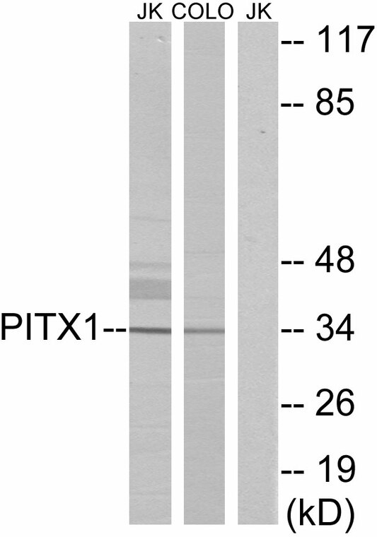 a02993 pitx1 primary antibodyes wb testing 3
