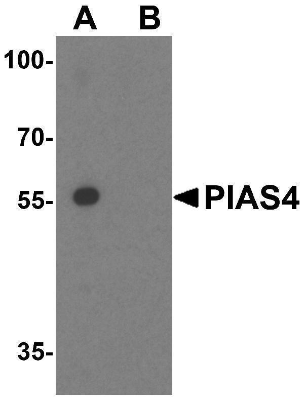 Western blot analysis of PIAS4 in HL60 cell lysate with PIAS4 antibody at 1 μg/mL in (A) the absence and (B) the presence of blocking peptide