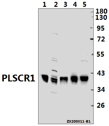Western blot (WB) analysis of PLSCR1 pAb at 1:500 dilution
Lane1:H9C2 whole cell lysate(40ug)
Lane2:CT26 whole cell lysate(40ug)
Lane3:HepG2 whole cell lysate(40ug)
Lane4:HCT116 whole cell lysate(40ug)
Lane5:A549 whole cell lysate(40ug)