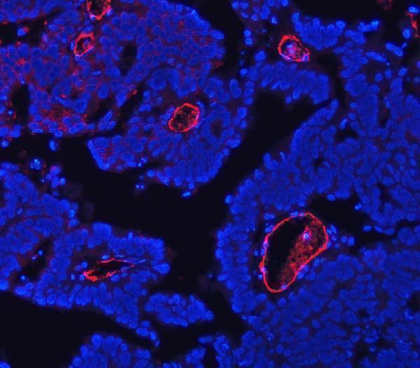a02997 3 eng primary antibodies if testing 6