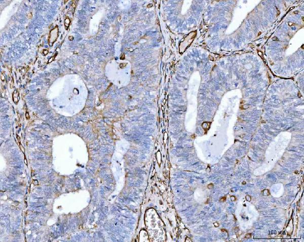 a02997 3 eng primary antibodies ihc testing 5_1