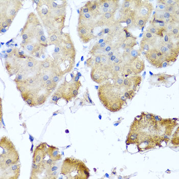 a03001 nin primary antiboties ihc testing 2
