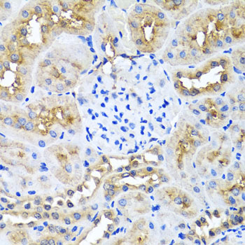 a03001 nin primary antiboties ihc testing 3