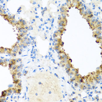 a03001 nin primary antiboties ihc testing 4