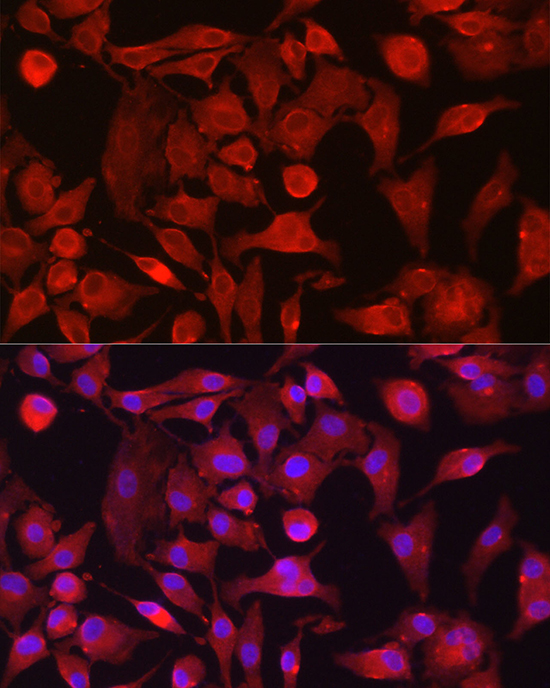 a03004 rasgrp1 primary antiboties if testing 2