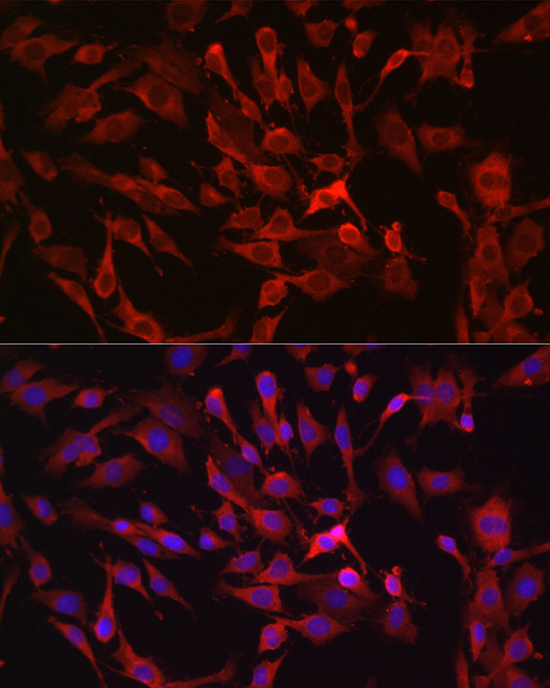 a03004 rasgrp1 primary antiboties if testing 3