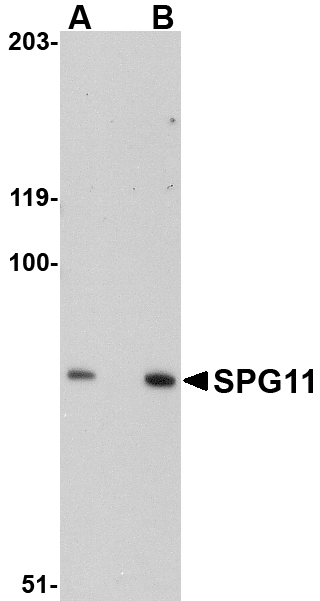 a03005 spg11 primary antibodies wb testing 1