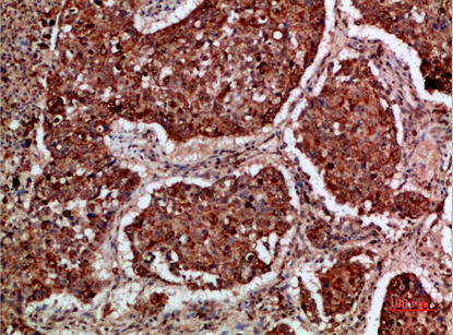 a03007 imp3 primary antibodies ihc testing 1