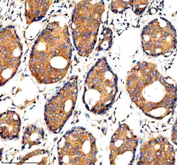  IHC analysis of ADAMTS1 using anti-ADAMTS1 antibody (A03009-2)