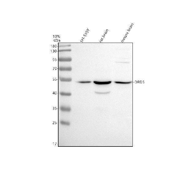 Western blot analysis of DRD5 using anti-DRD5 antibody (A03010-2)