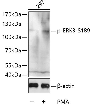 Western blot analysis of extracts of 293 cells, using Phospho-ERK3-S189 antibody