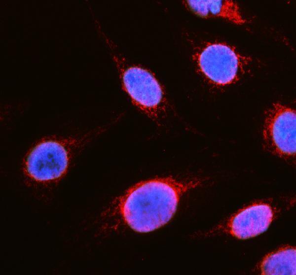 a03012 1 yme1l1 primary antibodies if testing 1