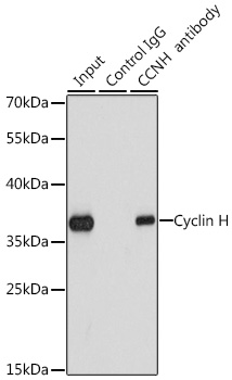 a03013 1 ccnh primary antiboties ip testing 1