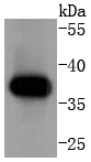 a03013 2 ccnh primary antiboties wb testing 1