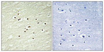 a03013 3 ccnh primary antibodyes ihc testing 2