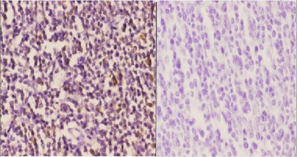 a03013 ccnh primary antiboties ihc testing 2